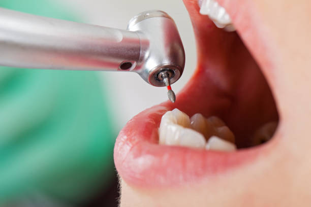 Best Pediatric Emergency Dentist in Arvin, CA